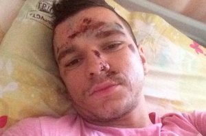 Новости «Дом-2»: Антон Гусев оправдывает сбившего его водителя: «Он спас мн ...