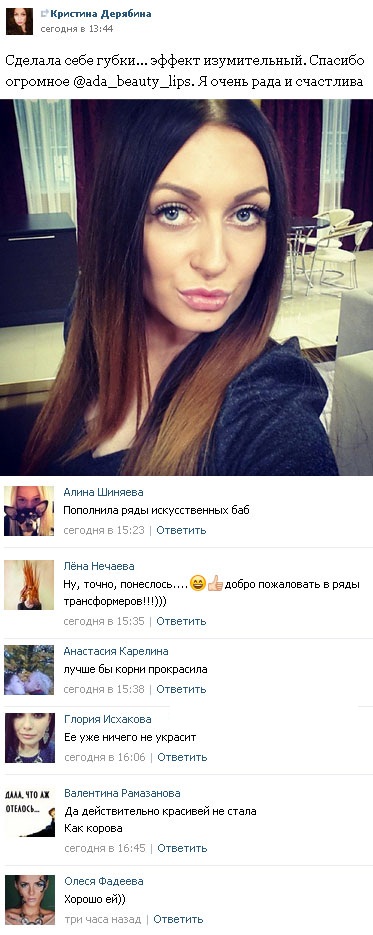Новости «Дом-2»: Кристина Дерябина увеличила губы и осталась довольна результатом – фото 
