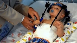 Врачи научились пришивать оторванную голову и спасли малыша после аварии