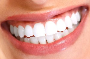 Имплантация - самая популярная технология восстановления зубов