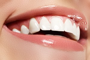 Стоматологи рекомендуют эффективные способы отбеливания зубной эмали
