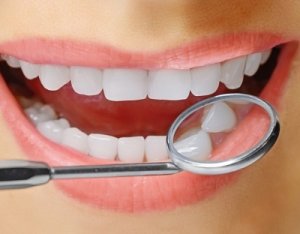Стоматологи «32 Дент» осуществляют экспресс-имплантацию зубов за три дня