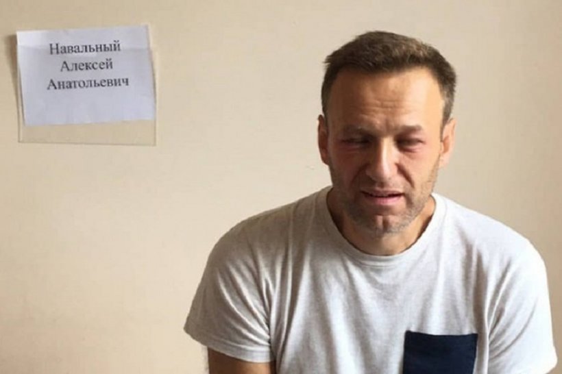Состояние Навального улучшается – немецкие врачи
