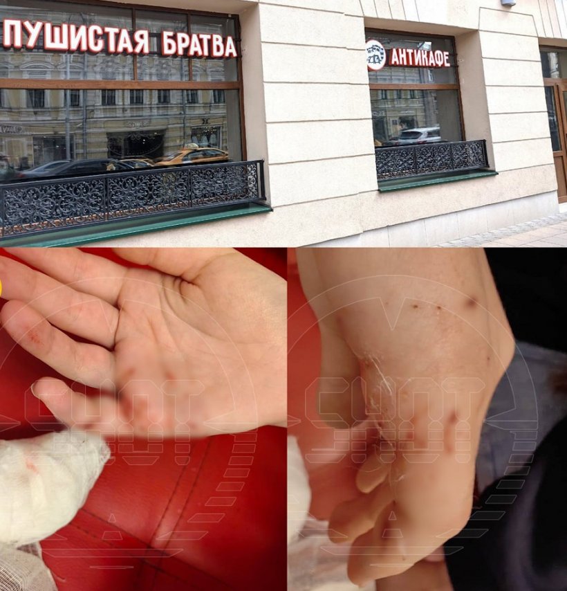 Енот напал и искусал 16-летнюю девочку в антикафе с животными «Пушистая братва» в центре Москвы