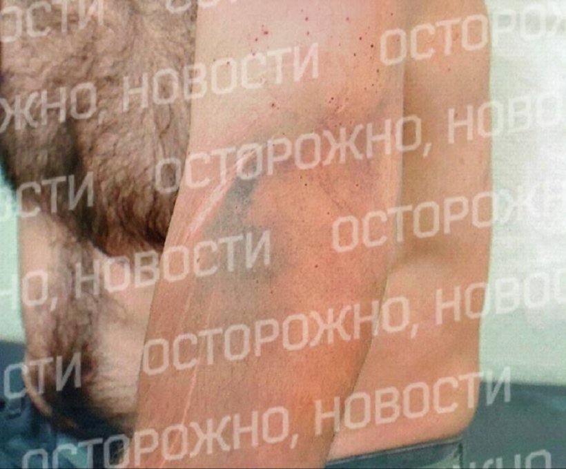 Полицейские избили мужчину, пытали его электрошоком и закапывали в яму в Самарской области. О случае заявил адвокат