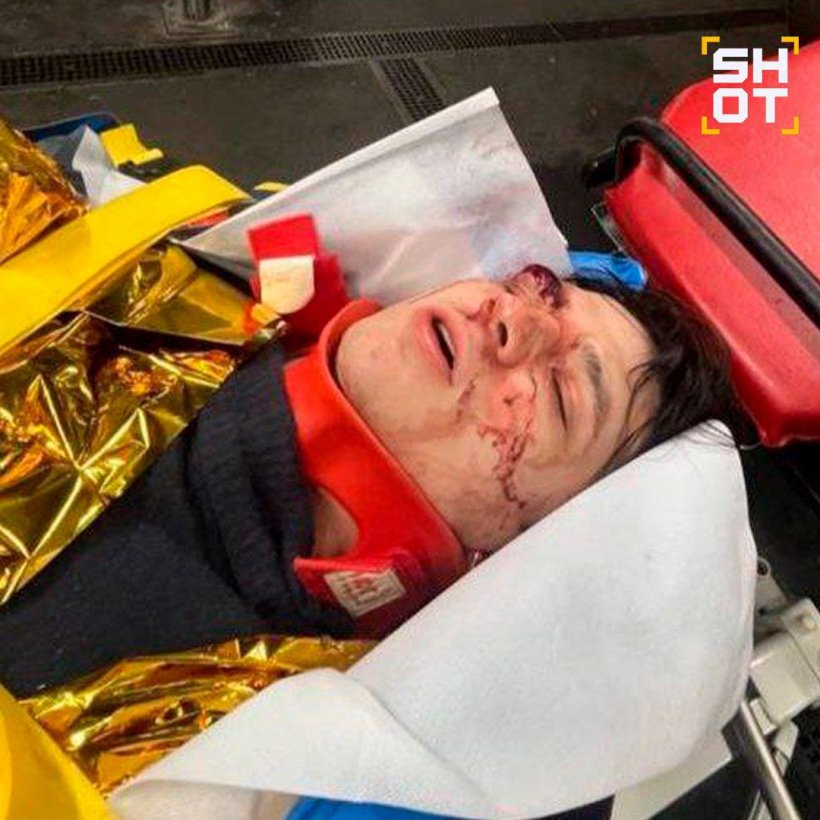 Рэпер VACIO оказался в реанимации в тяжелом состоянии после падения сквозь стеклянную крышу в Париже 
