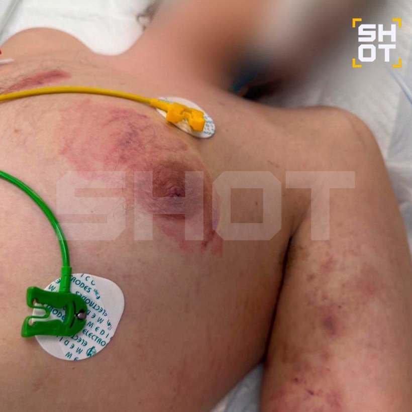 Владелицу «хоррор-рехаба» для пыток Анну Хоботову объявили в розыск. Бизнесменка пустилась в бега