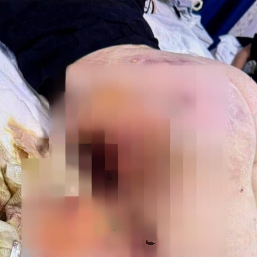 «Мясник» в халате: десятки женщин заявили о тяжелых последствиях процедур в клинике Алгасановой