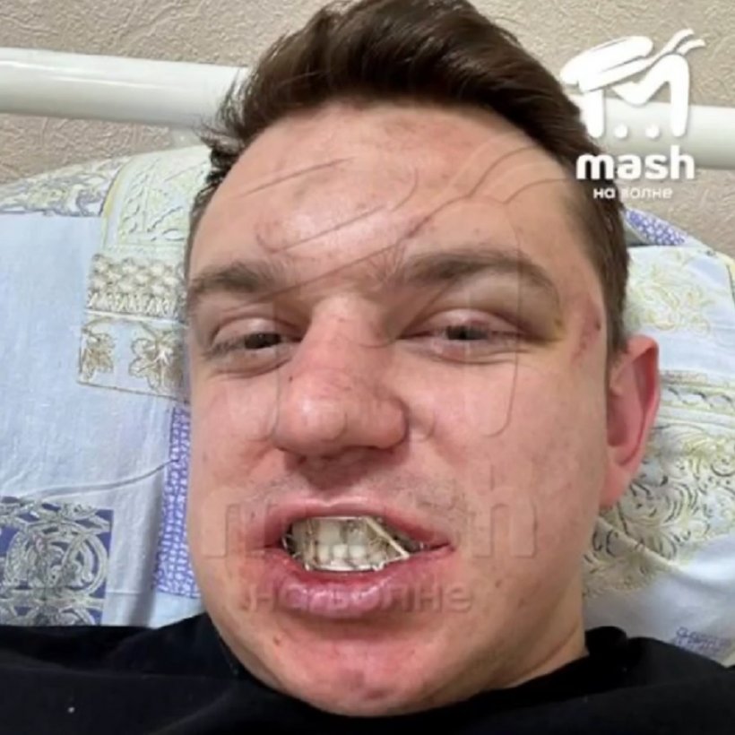 Посетители симферопольского кафе около часа избивали официанта из-за того, что он предупредил, что заведение закрывается 