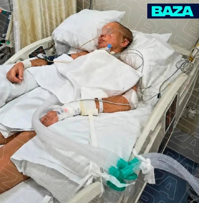 Российская туристка впала в кому, поскользнувшись во время отпуска в турецком отеле